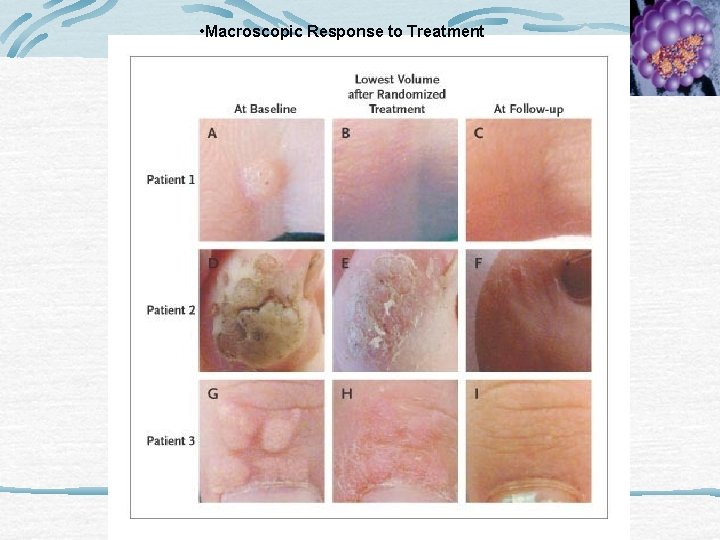  • Macroscopic Response to Treatment 