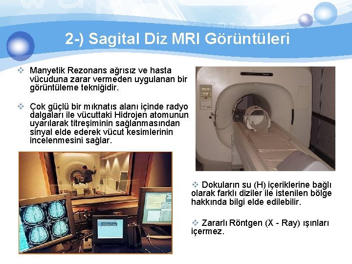2 -) Sagital Diz MRI Görüntüleri v Manyetik Rezonans ağrısız ve hasta vücuduna zarar