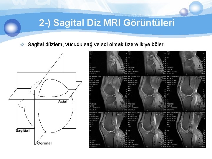2 -) Sagital Diz MRI Görüntüleri v Sagital düzlem, vücudu sağ ve sol olmak