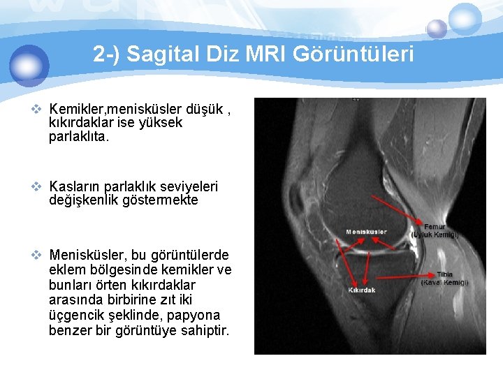 2 -) Sagital Diz MRI Görüntüleri v Kemikler, menisküsler düşük , kıkırdaklar ise yüksek
