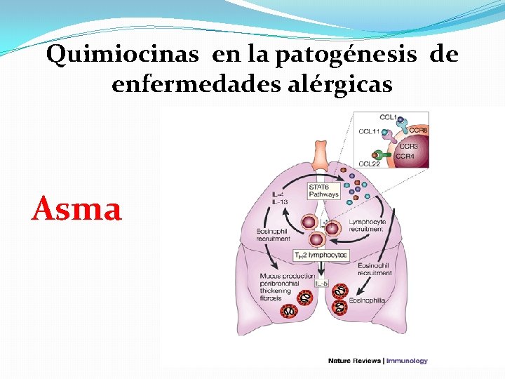 Quimiocinas en la patogénesis de enfermedades alérgicas Asma 