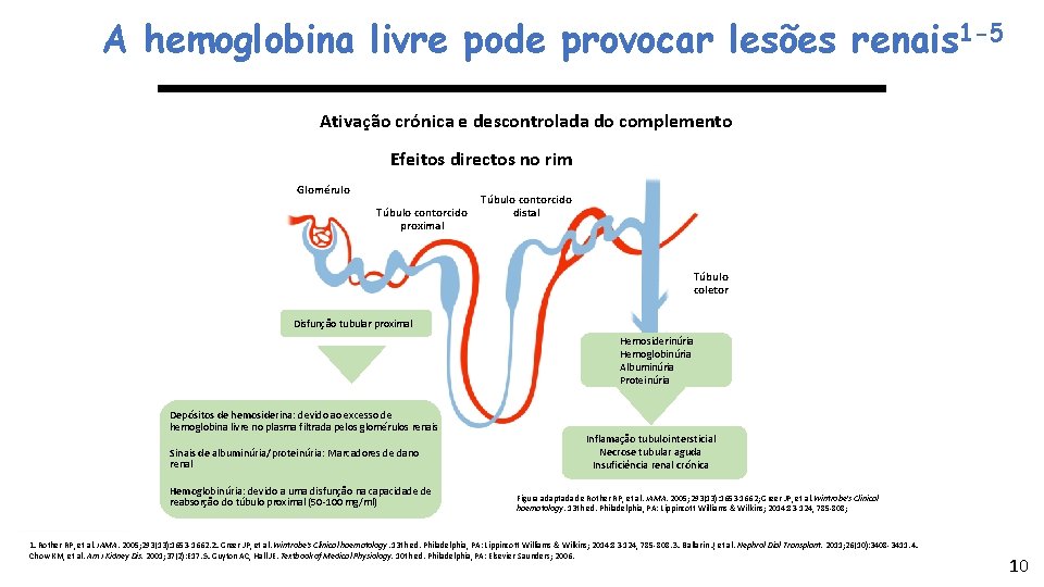 A hemoglobina livre pode provocar lesões renais 1 -5 Ativação crónica e descontrolada do