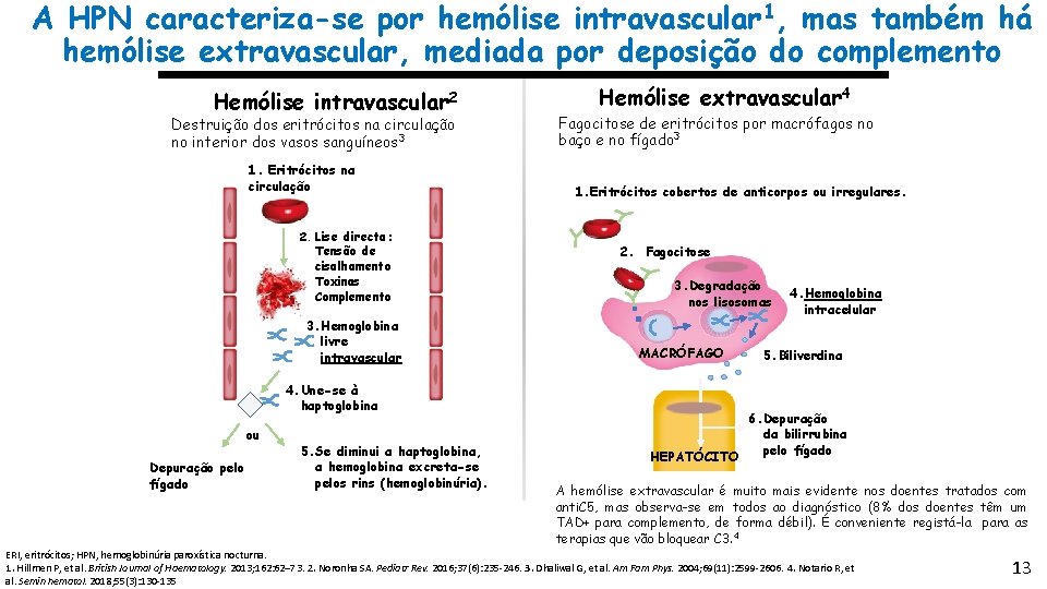 A HPN caracteriza-se por hemólise intravascular 1, mas também há hemólise extravascular, mediada por