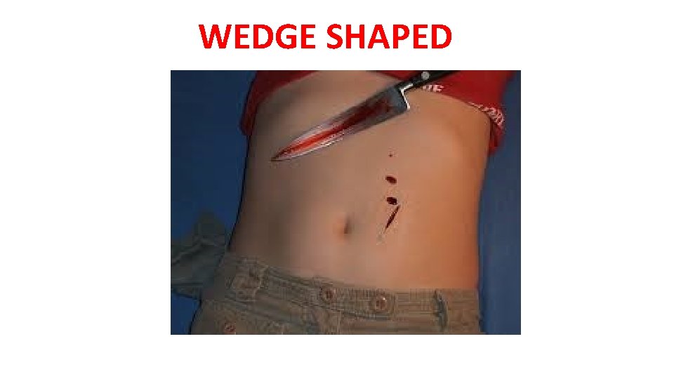 WEDGE SHAPED WEDGE SHAPED