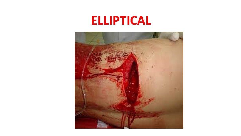 ELLIPTICAL ELLIPTICAL