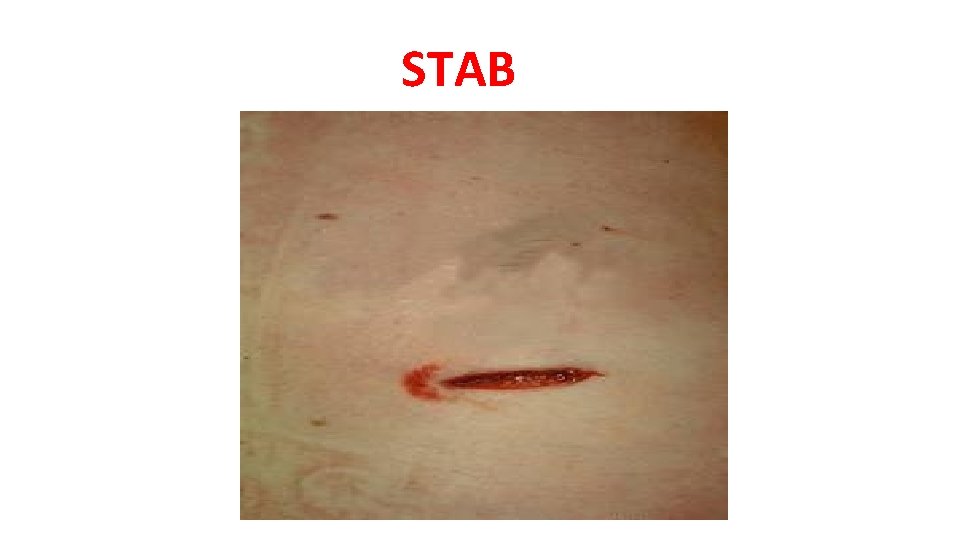 STAB STAB