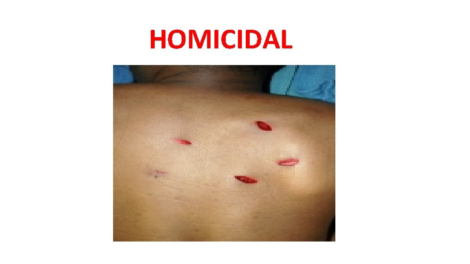 HOMICIDAL HOMICIDAL