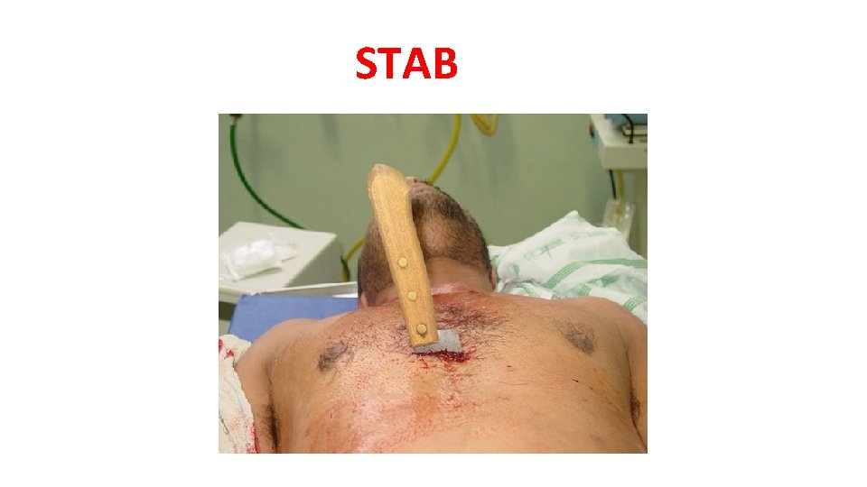 STAB STAB
