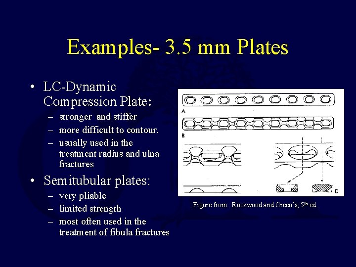 Examples- 3. 5 mm Plates • LC-Dynamic Compression Plate: – stronger and stiffer –