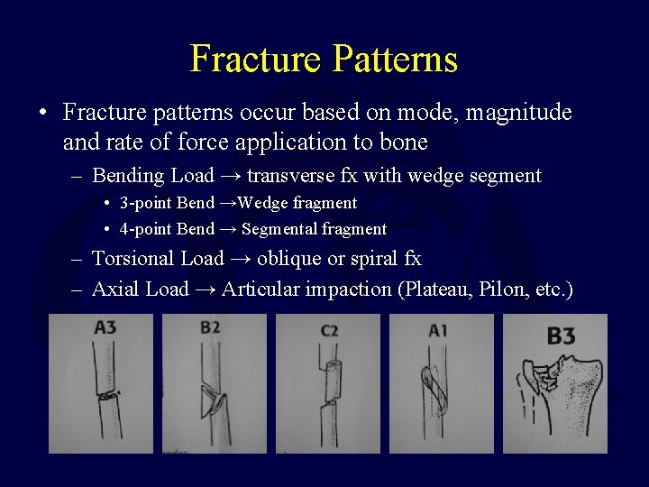 Fracture Patterns • Fracture patterns occur based on mode, magnitude and rate of force