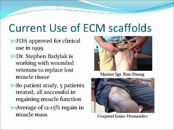 Current Use of ECM scaffolds FDA approved for clinical use in 1999 Dr. Stephen