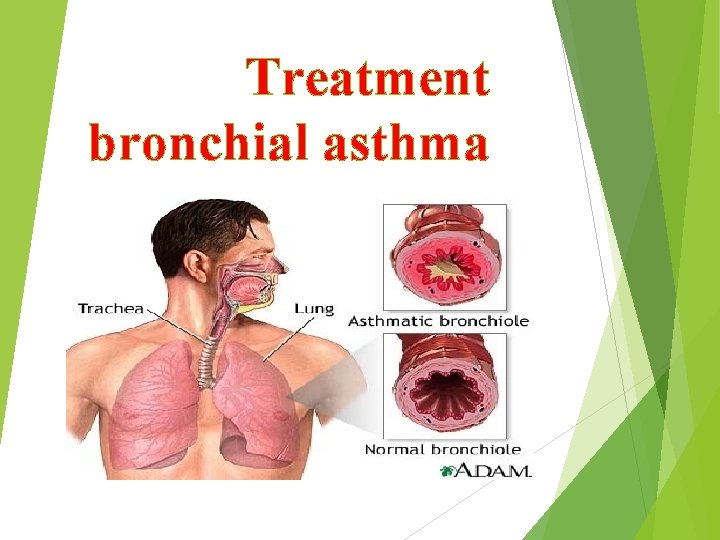 Treatment bronchial asthma 