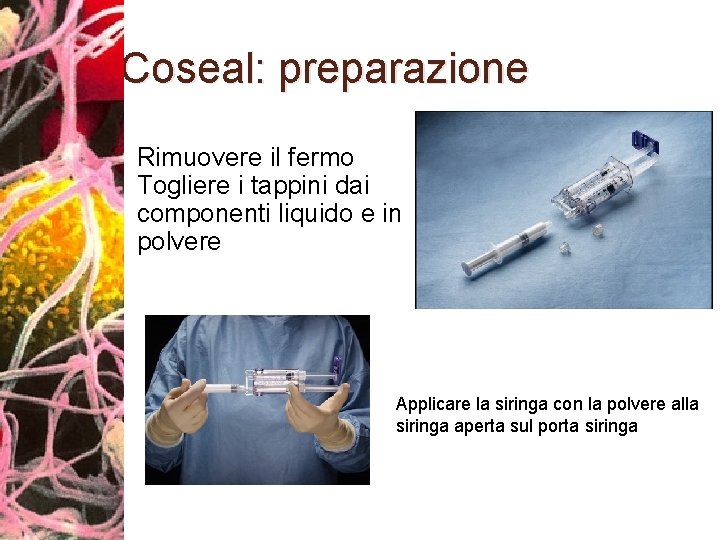Coseal: preparazione Rimuovere il fermo Togliere i tappini dai componenti liquido e in polvere