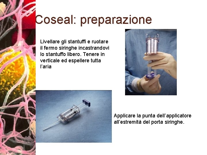 Coseal: preparazione Livellare gli stantuffi e ruotare il fermo siringhe incastrandovi lo stantuffo libero.