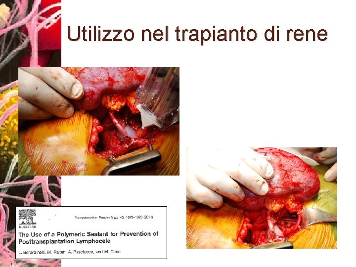 Utilizzo nel trapianto di rene 