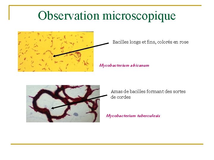 Observation microscopique Bacilles longs et fins, colorés en rose Mycobacterium africanum Amas de bacilles