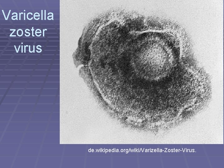 Varicella zoster virus de. wikipedia. org/wiki/Varizella-Zoster-Virus. 
