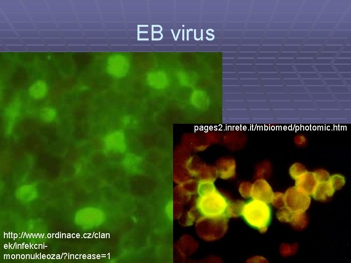 EB virus pages 2. inrete. it/mbiomed/photomic. htm http: //www. ordinace. cz/clan ek/infekcnimononukleoza/? increase=1 