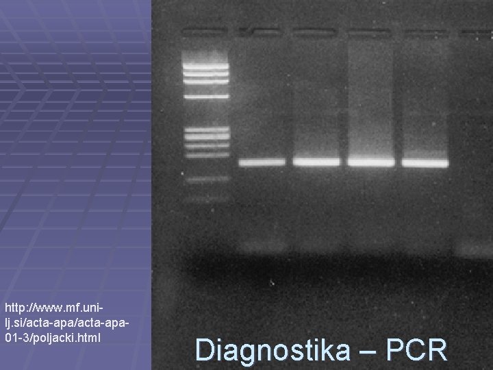 http: //www. mf. unilj. si/acta-apa 01 -3/poljacki. html Diagnostika – PCR 