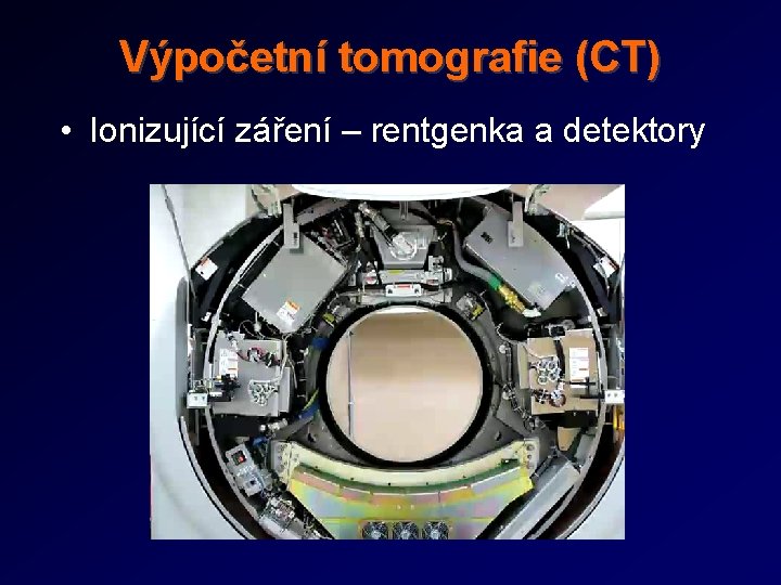 Výpočetní tomografie (CT) • Ionizující záření – rentgenka a detektory 