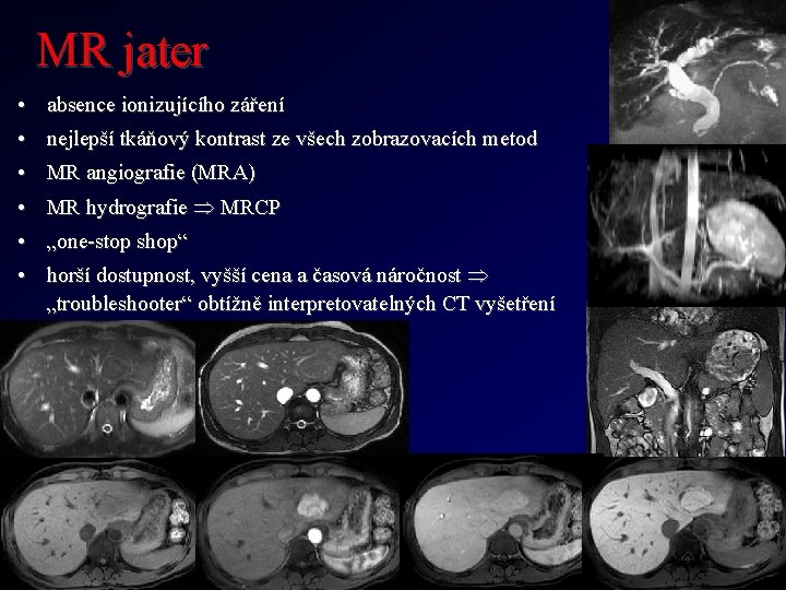 MR jater • absence ionizujícího záření • nejlepší tkáňový kontrast ze všech zobrazovacích metod