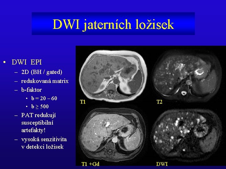 DWI jaterních ložisek • DWI EPI – – – 2 D (BH / gated)