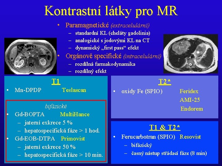 Kontrastní látky pro MR • Paramagnetické (extracelulární) – standardní KL (cheláty gadolinia) – analogické