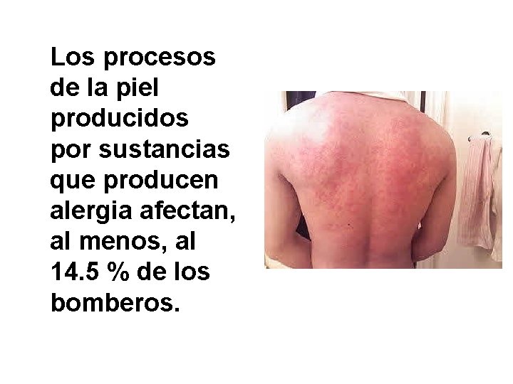 Los procesos de la piel producidos por sustancias que producen alergia afectan, al menos,