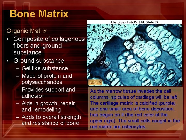 Bone Matrix Organic Matrix • Composite of collagenous fibers and ground substance • Ground