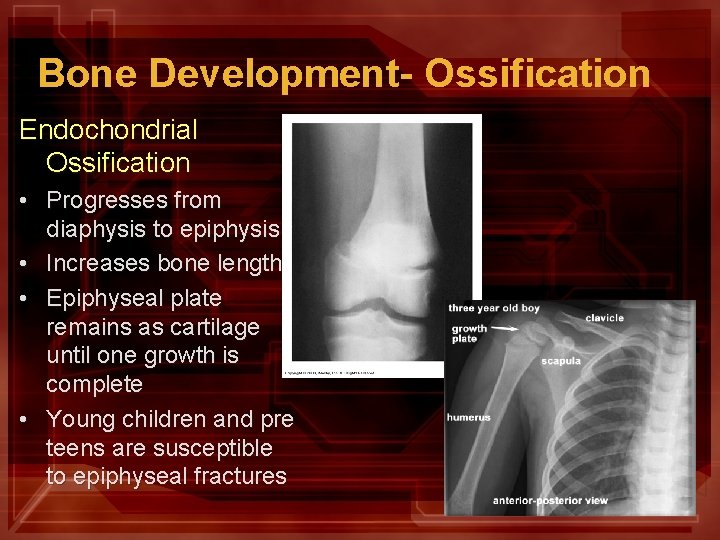 Bone Development- Ossification Endochondrial Ossification • Progresses from diaphysis to epiphysis • Increases bone
