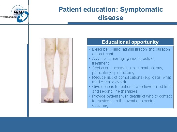 Patient education: Symptomatic disease Educational opportunity • Describe dosing, administration and duration of treatment