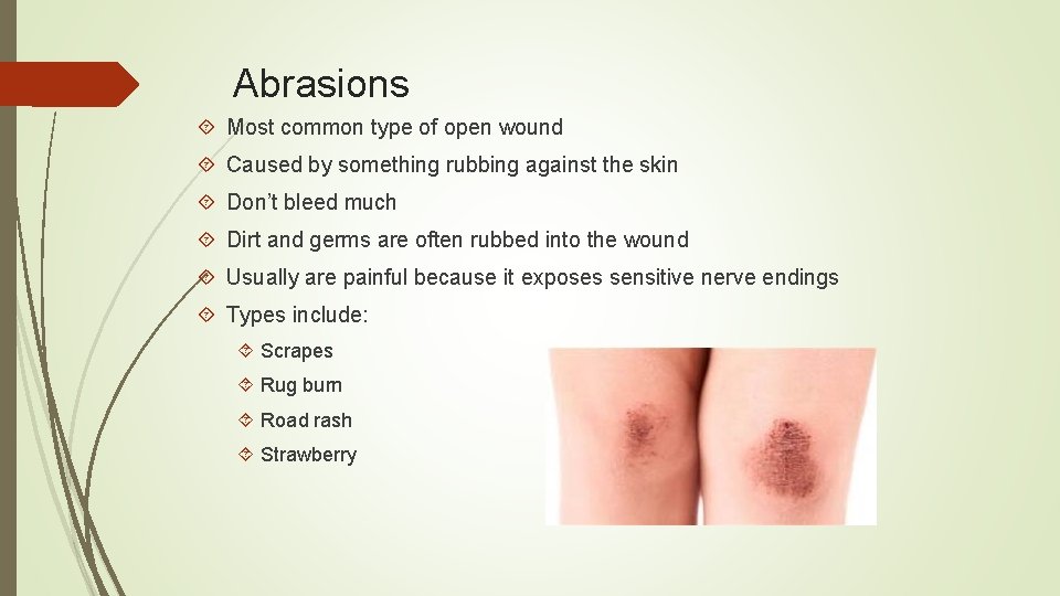 Abrasions Most common type of open wound Caused by something rubbing against the skin
