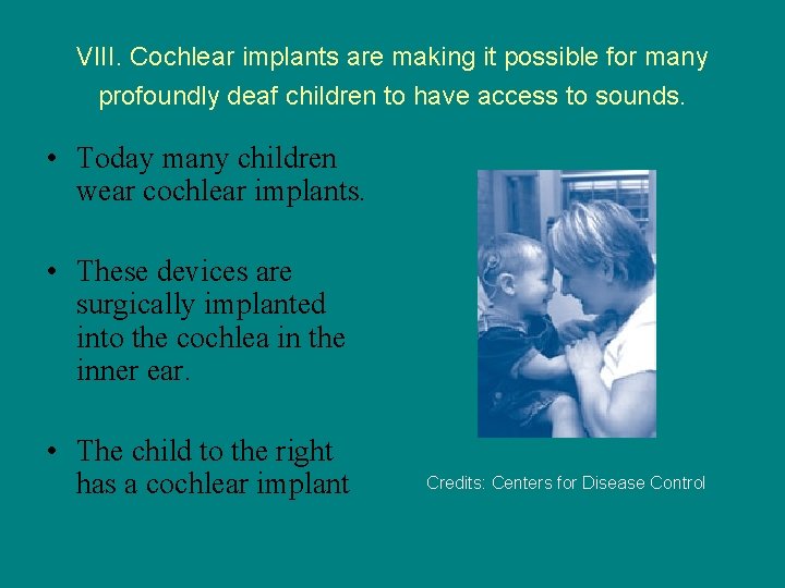 VIII. Cochlear implants are making it possible for many profoundly deaf children to have