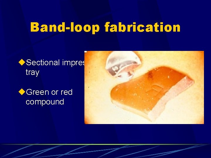 Band-loop fabrication u. Sectional impression tray u. Green or red compound 