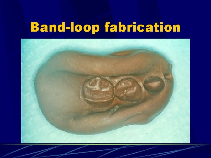 Band-loop fabrication 