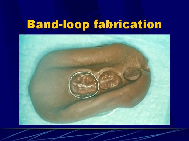 Band-loop fabrication 