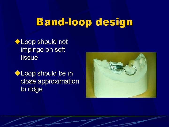Band-loop design u. Loop should not impinge on soft tissue u. Loop should be