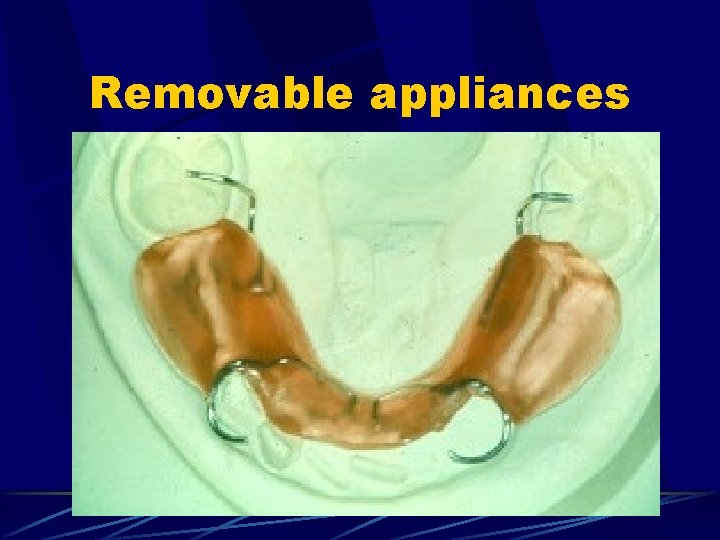 Removable appliances 