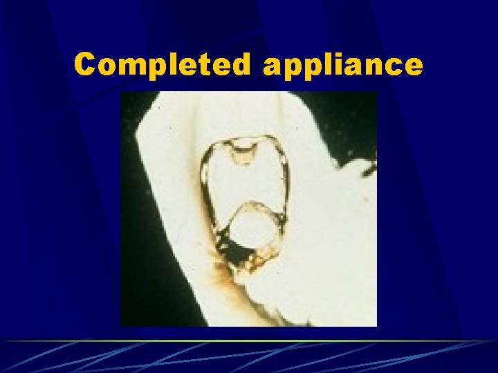 Completed appliance 
