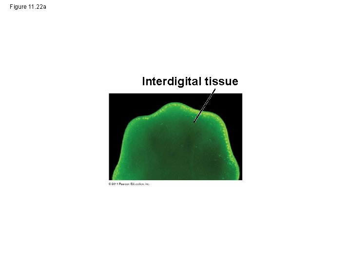 Figure 11. 22 a Interdigital tissue 