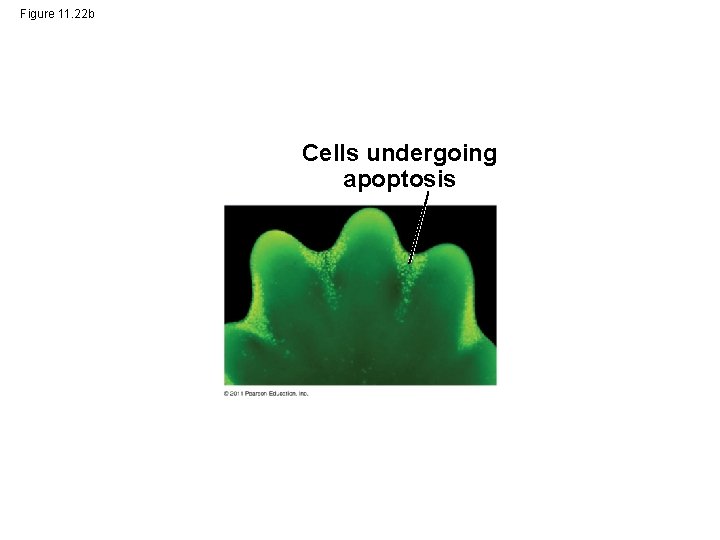Figure 11. 22 b Cells undergoing apoptosis 