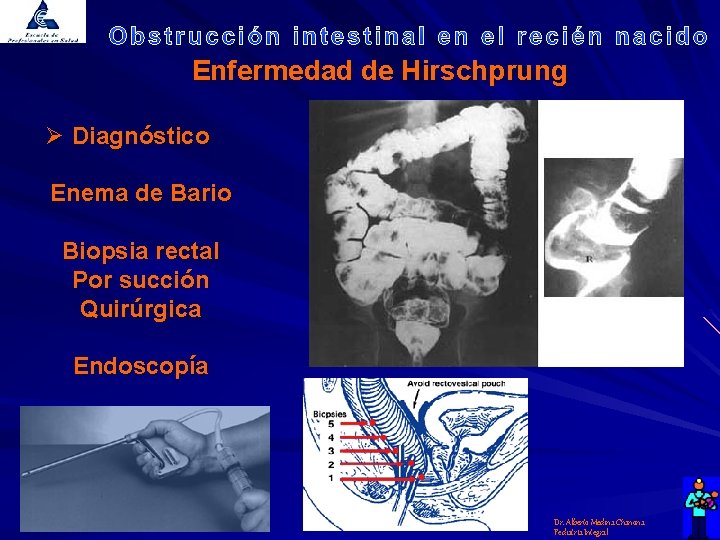 Enfermedad de Hirschprung Ø Diagnóstico Enema de Bario Biopsia rectal Por succión Quirúrgica Endoscopía