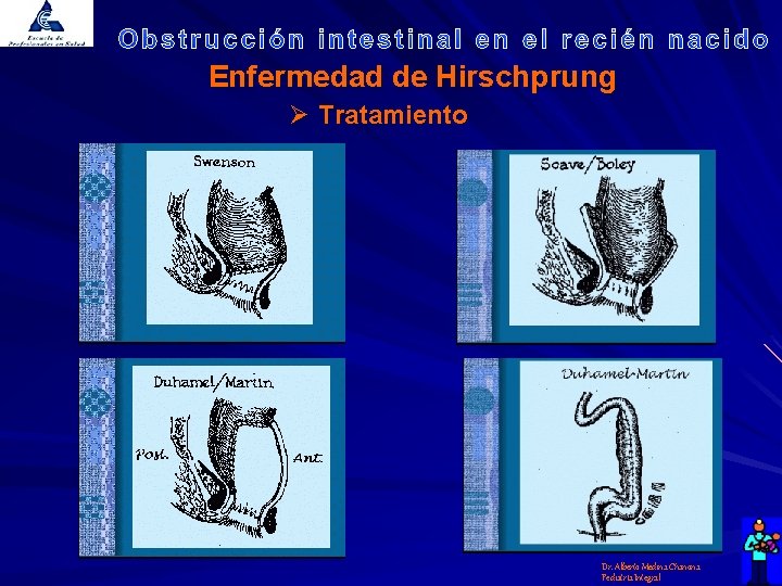 Enfermedad de Hirschprung Ø Tratamiento Dr. Alberto Medina Chanona Pediatría Integral 