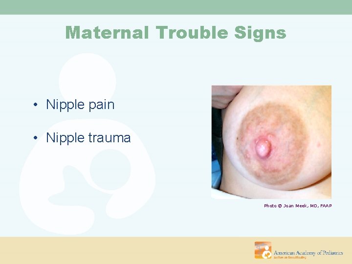 Maternal Trouble Signs • Nipple pain • Nipple trauma Photo © Joan Meek, MD,