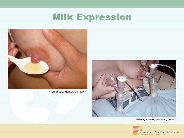 Milk Expression Photo © Jane Morton, MD, FAAP Photo © Kay Hoover, MEd, IBCLC