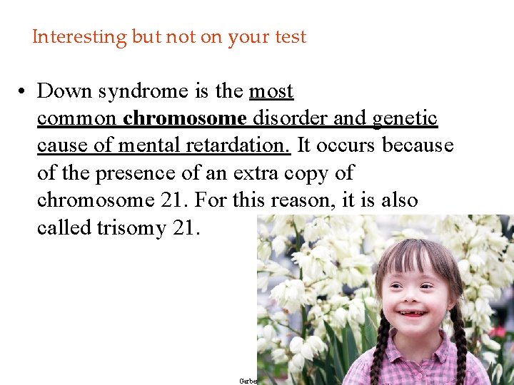 Interesting but not on your test • Down syndrome is the most common chromosome