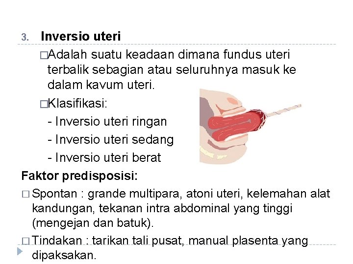 Inversio uteri �Adalah suatu keadaan dimana fundus uteri terbalik sebagian atau seluruhnya masuk ke