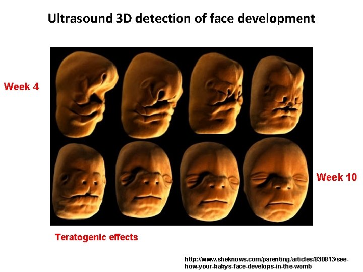 Ultrasound 3 D detection of face development Week 4 Week 10 Teratogenic effects http: