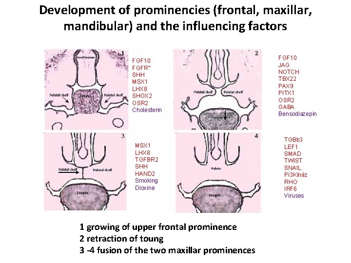 Development of prominencies (frontal, maxillar, mandibular) and the influencing factors FGF 10 FGFR” SHH