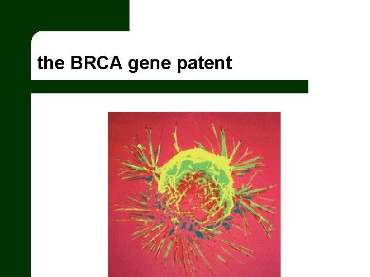 the BRCA gene patent 